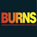 Burns